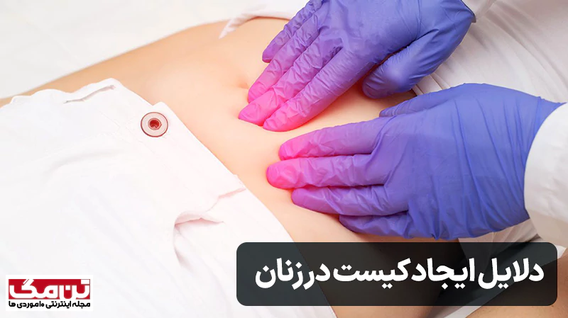 دلایل ایجاد کیست در زنان