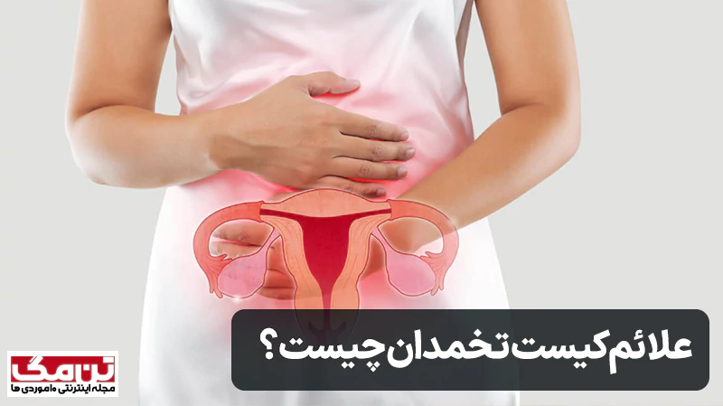 علائم کیست تخمدان چیست؟
